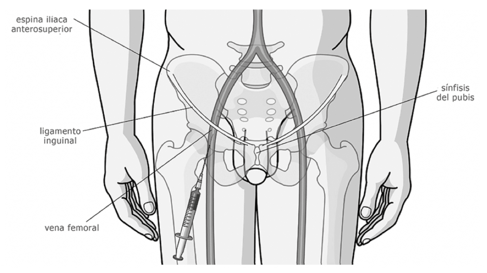 Figura 1